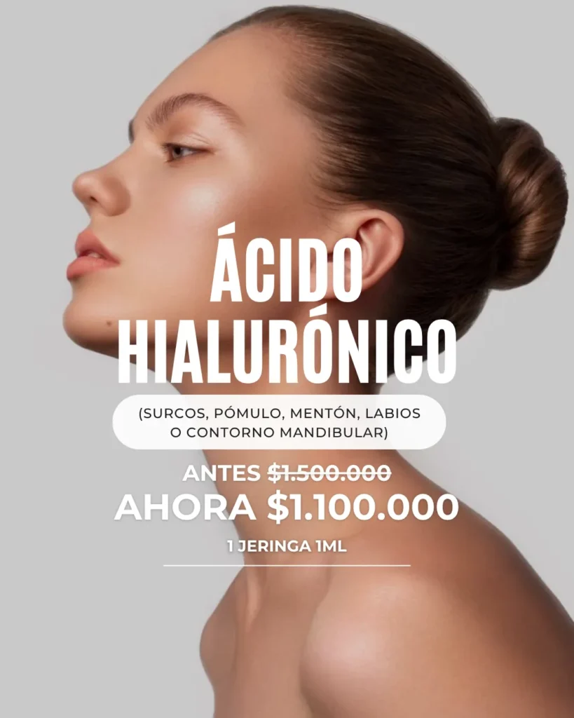 Ácido Hialurónico en Barranquilla