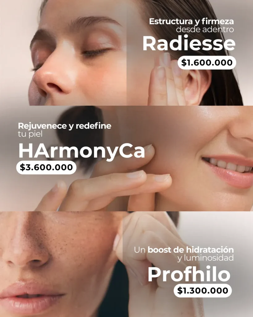 Bioestimuladores