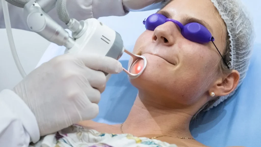 Láser CO2 fraccionado: el tratamiento favorito para rejuvenecer y renovar tu piel