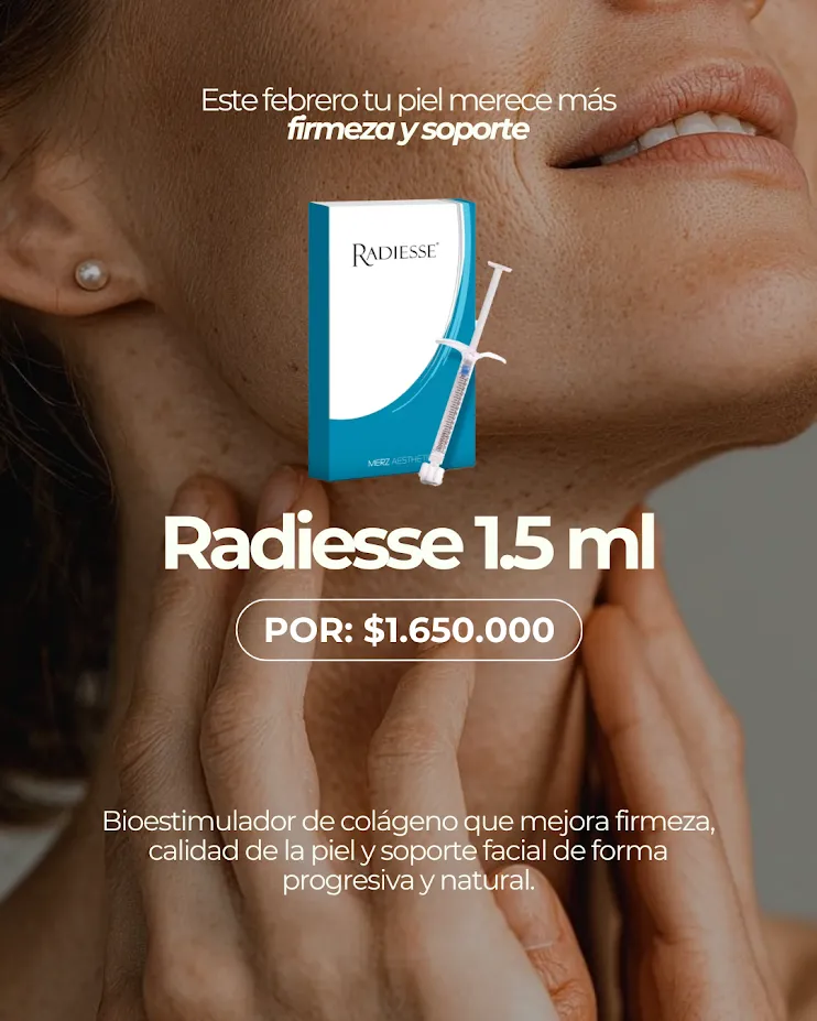 Radiesse 1.5 ml