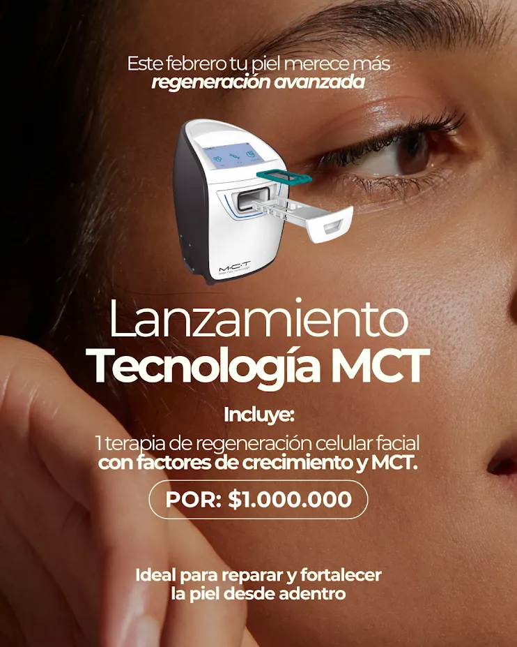 Tecnología MCT – Lanzamiento
