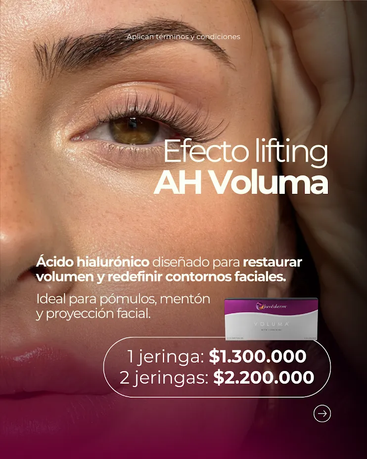 Ácido Hialurónico Voluma (Efecto Lifting)
