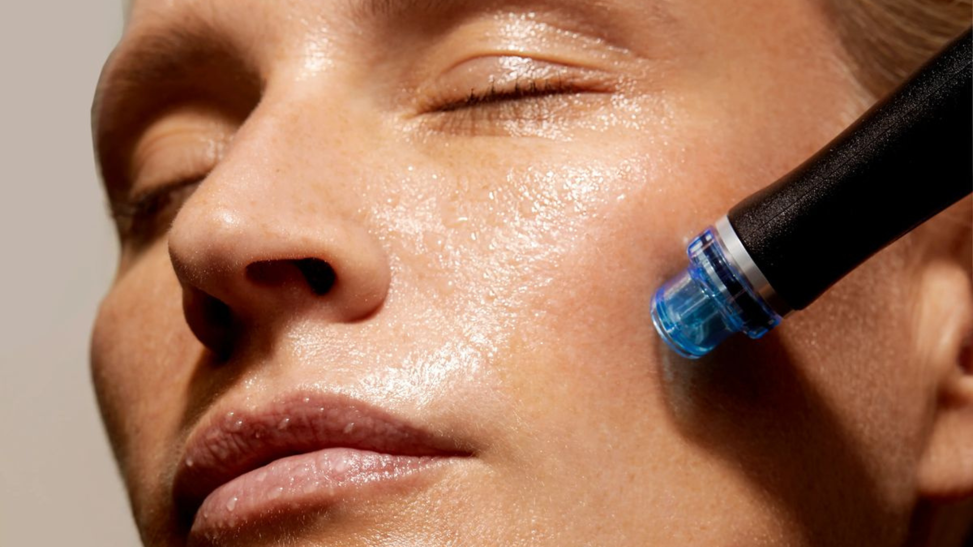 Hydrafacial para limpieza e hidratación profunda