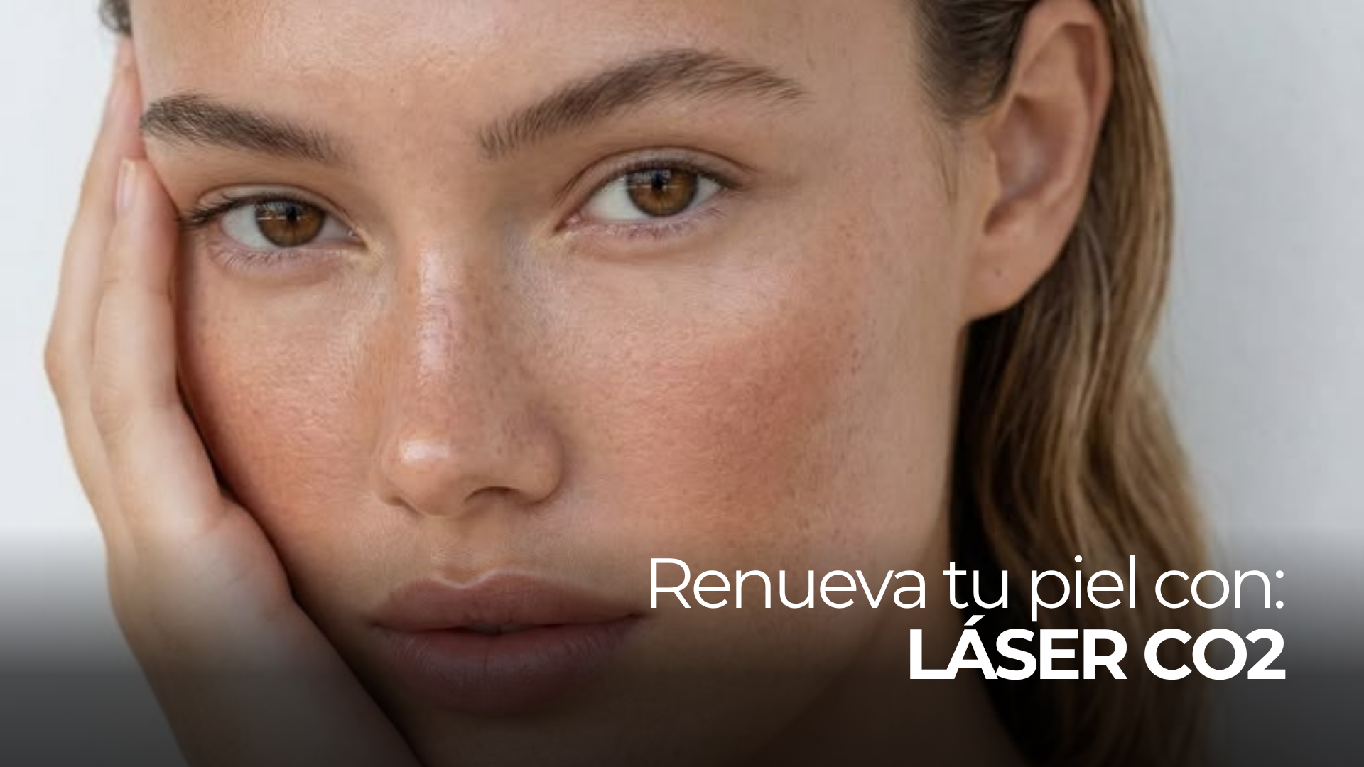 Láser CO2 para renovación profunda de la piel