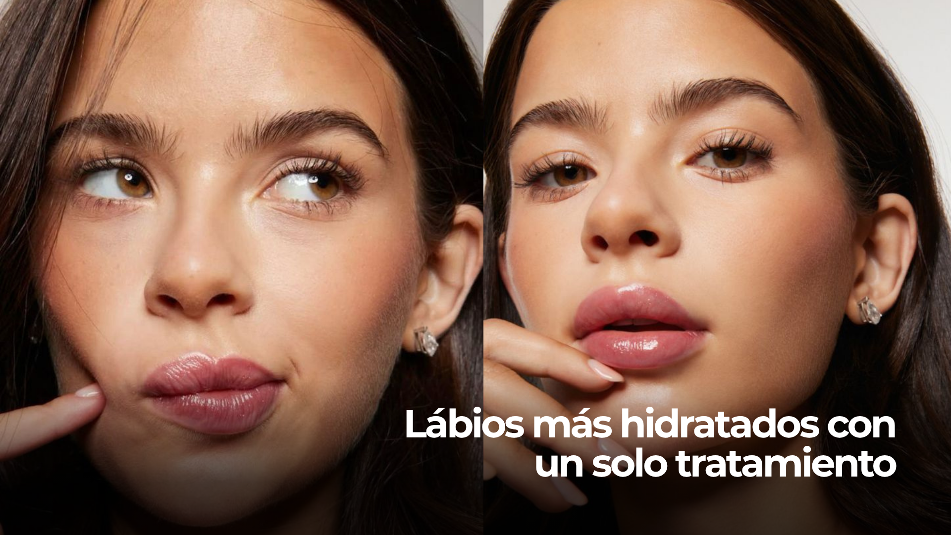Labios hidratados y perfilados con ácido hialurónico
