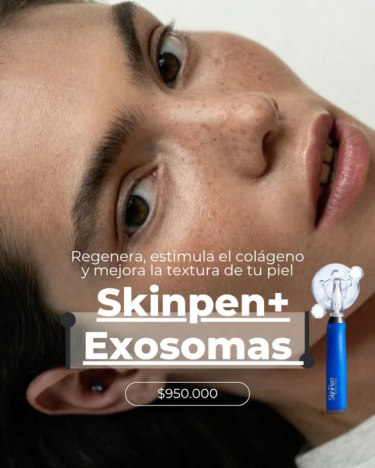 SkinPen + Exosomas