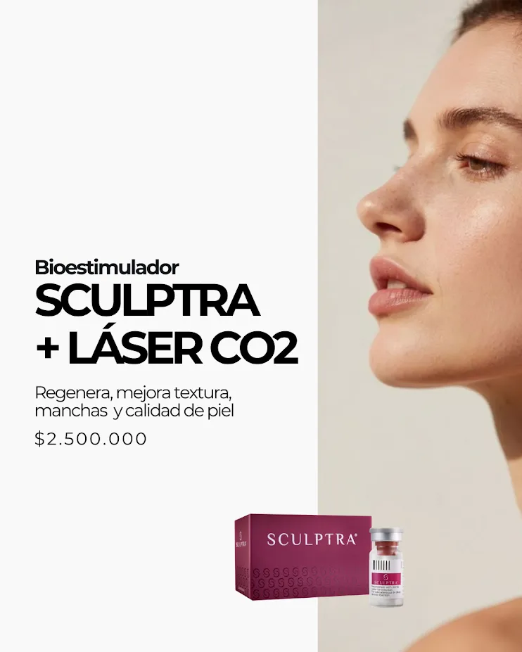 Sculptra + Láser CO2