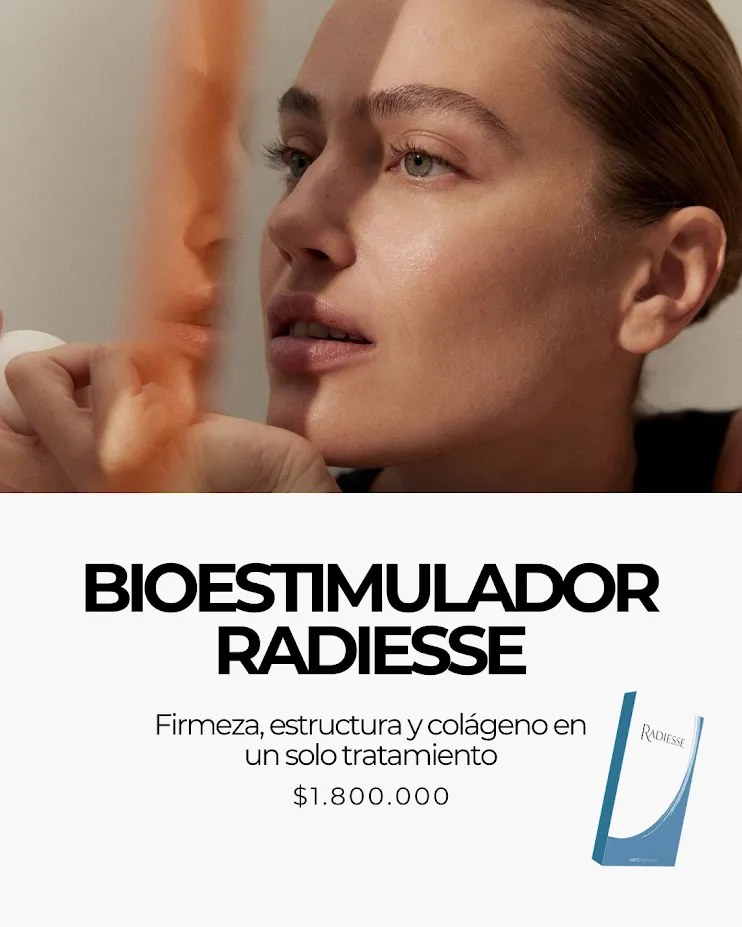 Radiesse