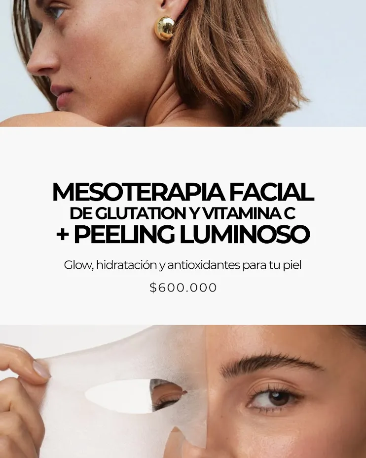 Mesoterapia facial de glutatión y vitamina C + Peeling luminoso