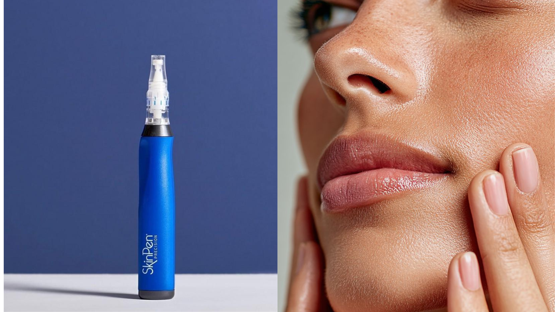 SkinPen: el secreto para conseguir una auténtica Glass Skin