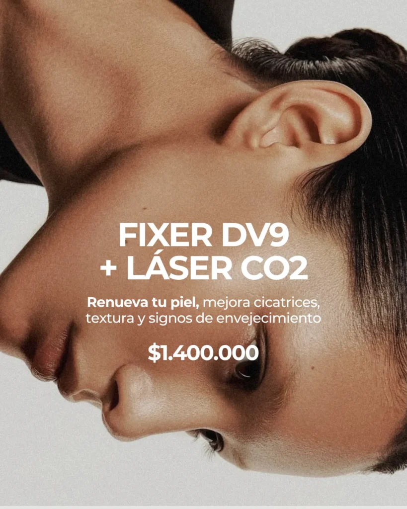 Fixer DV9 + Láser CO2