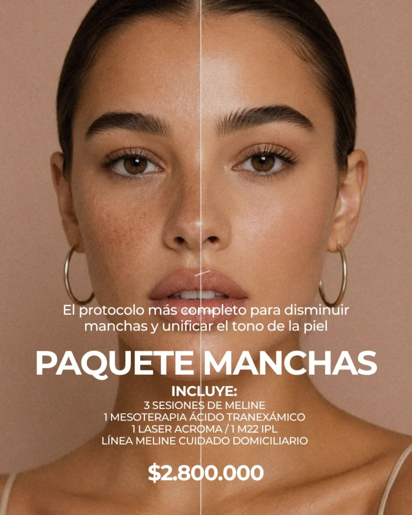 Paquete Manchas